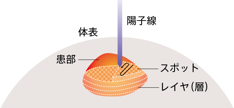 スポットスキャニング