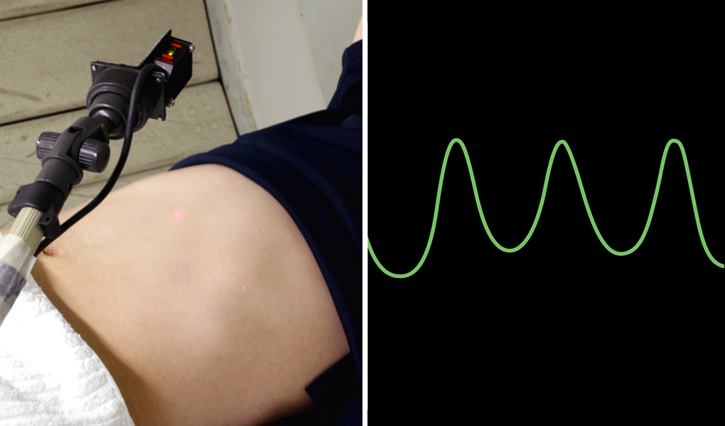 正確・安全性を高める呼吸同期システム