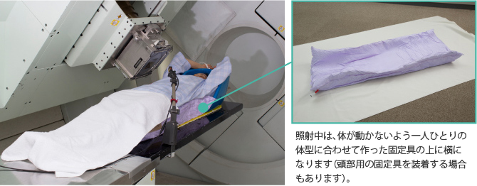 照射中は、体が動かないよう一人ひとりの体型に合わせて作った固定具の上に横になります（頭部用の固定具を装着する場合もあります）。