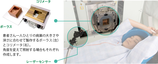 患者さん一人ひとりの病巣の大きさや深さに合わせて製作するボーラス（左）とコリメータ（右）。角度を変えて照射する場合もそれぞれ作成します。