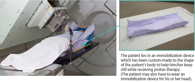 The patient lies in an immobilization device which has been custom-made to the shape of the patient’s body to help him/her keep still while receiving proton therapy. (The patient may also have to wear an immobilization device for his or her head).