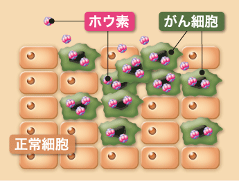 ホウ素剤入り薬剤を投与する