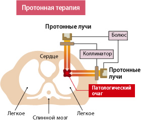 волочение